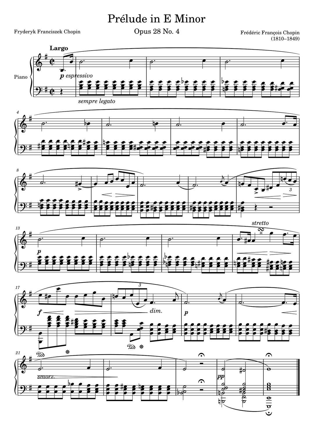 Preludio Op. 28 No. 4